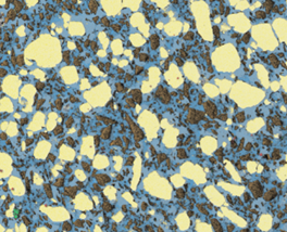 Multi-constituent Radiation Shielding MMC